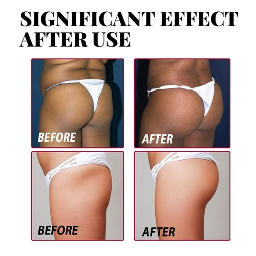 Butt Enhancement Cream – Lift, Firm & Plump Buttocks Naturally
