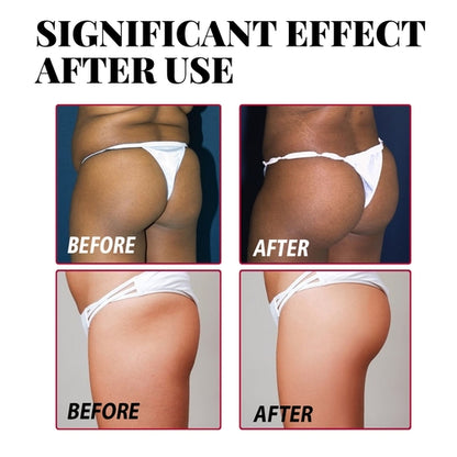 Butt Enhancement Cream – Lift, Firm & Plump Buttocks Naturally