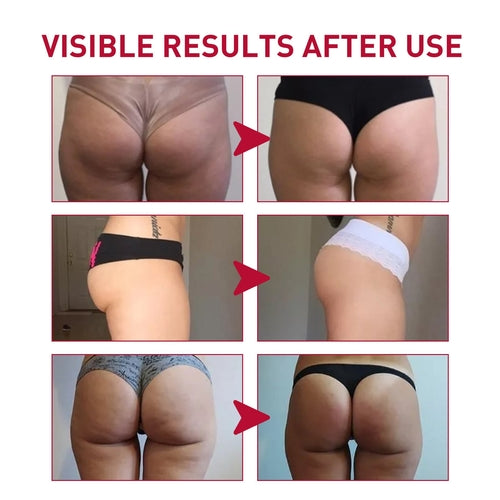Butt Enhancement Cream – Lift, Firm & Plump Buttocks Naturally