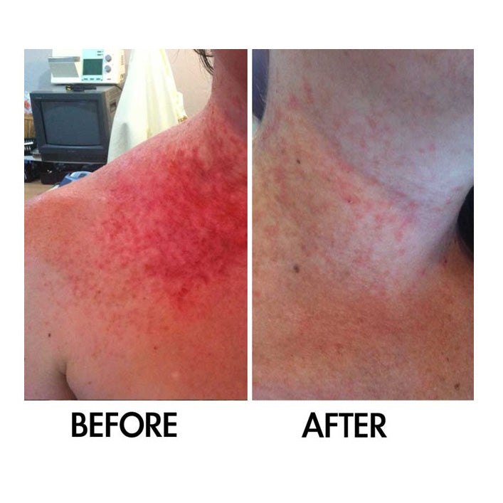 Derm #1 Dry Skin Rescue Moisturizer – 5% Niacinamide & Organic Oils 3.38 oz